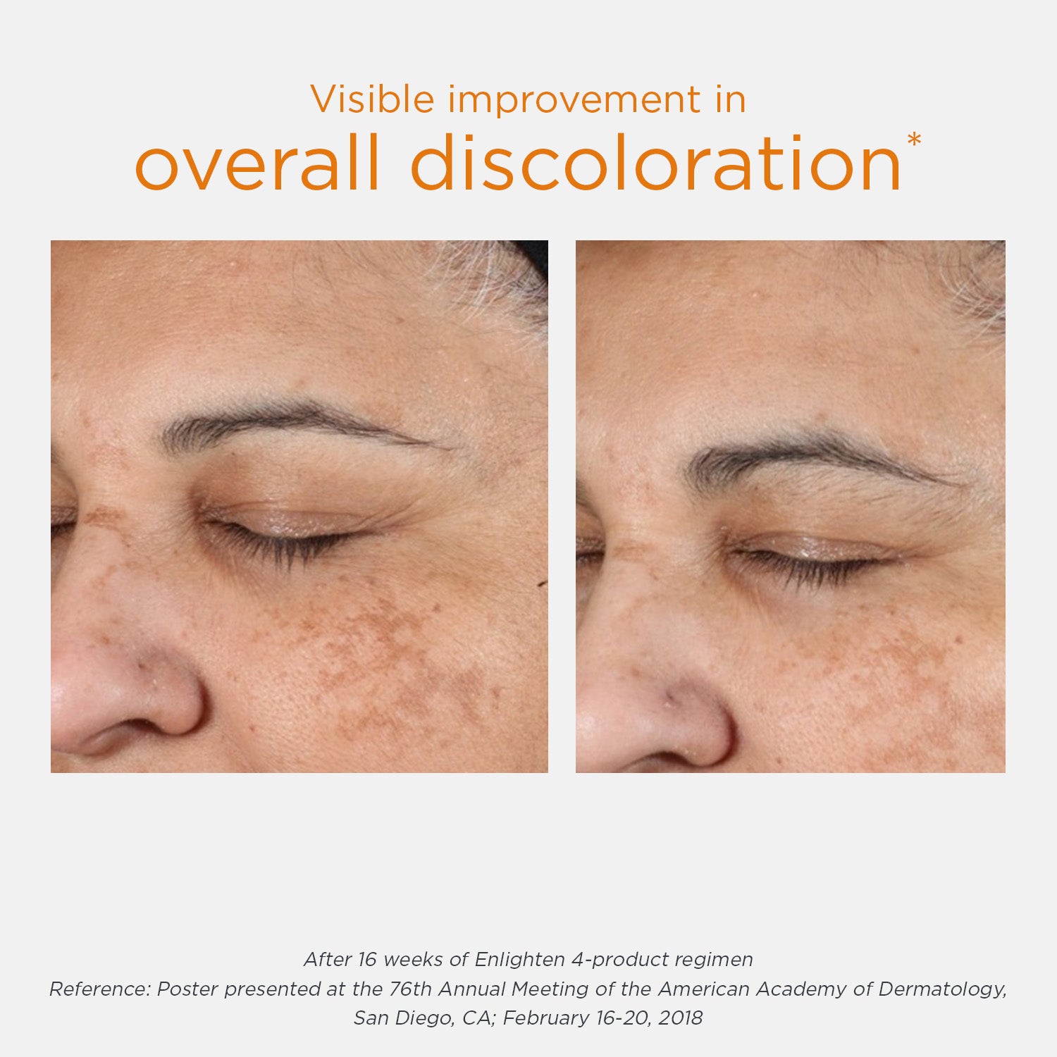 Free Gift Friday- NEOSTRATA